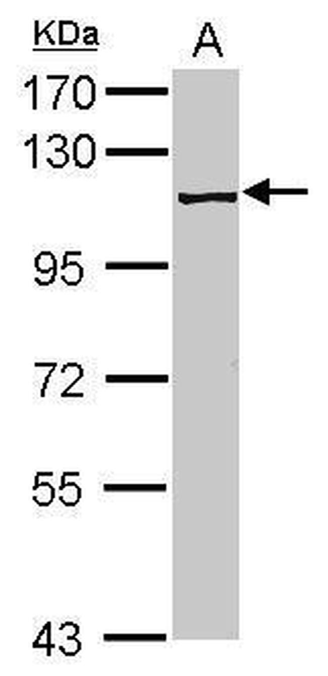 PRP6 Antibody in Western Blot (WB)