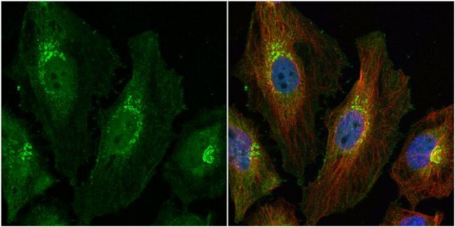 HGK Antibody in Immunocytochemistry (ICC/IF)