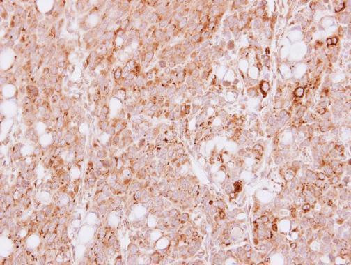 HGK Antibody in Immunohistochemistry (Paraffin) (IHC (P))