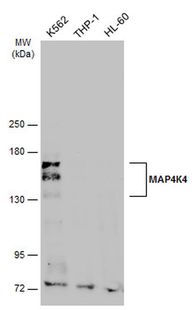 HGK Antibody in Western Blot (WB)