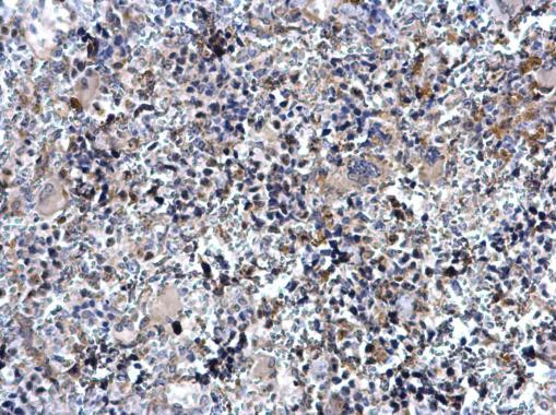 TAL1 Antibody in Immunohistochemistry (Paraffin) (IHC (P))