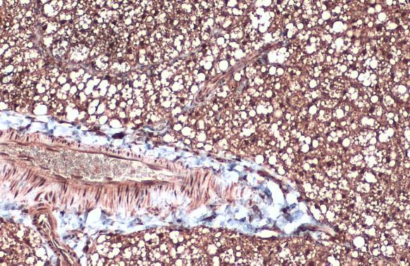 FABP4 Antibody in Immunohistochemistry (Paraffin) (IHC (P))