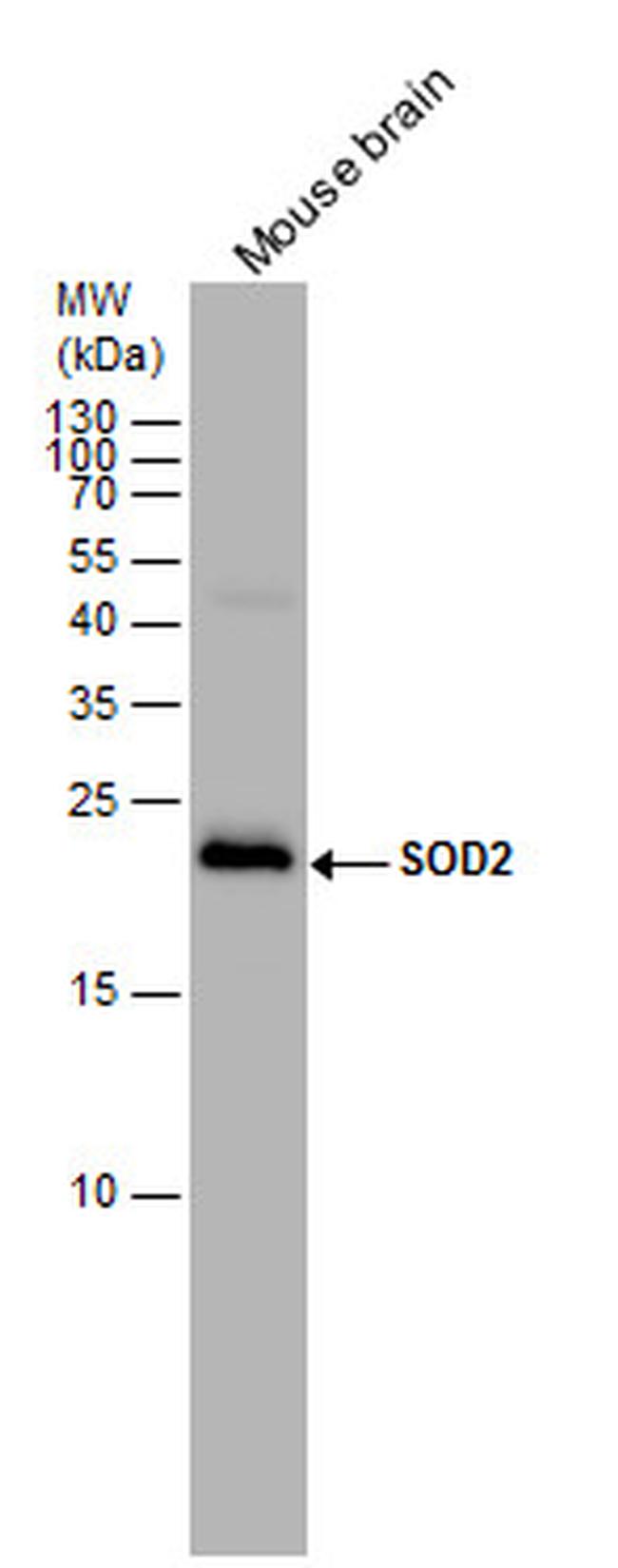 SOD2 Antibody in Western Blot (WB)