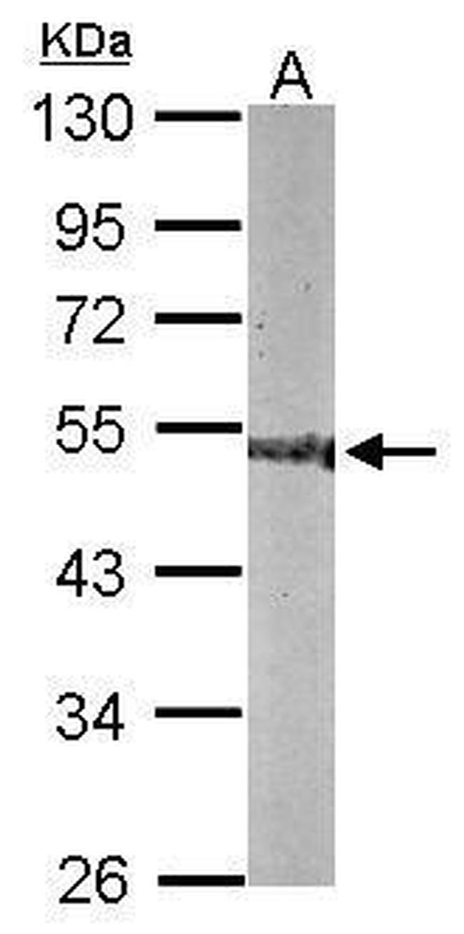 CNDP2 Antibody in Western Blot (WB)