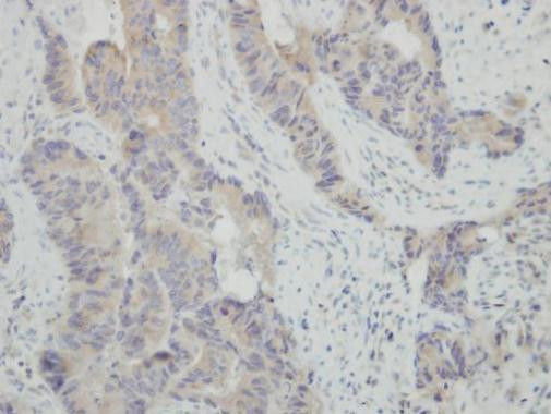 HSPBAP1 Antibody in Immunohistochemistry (Paraffin) (IHC (P))