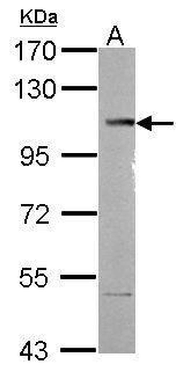 SETDB2 Antibody in Western Blot (WB)