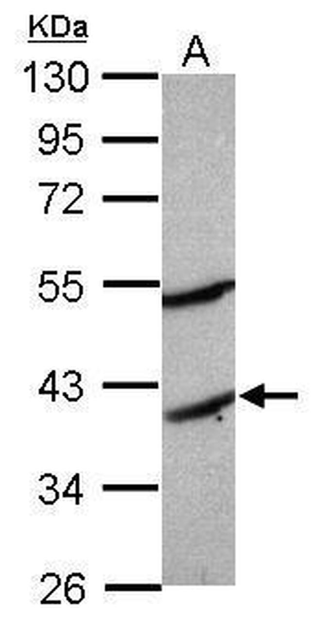 MOGAT2 Antibody in Western Blot (WB)