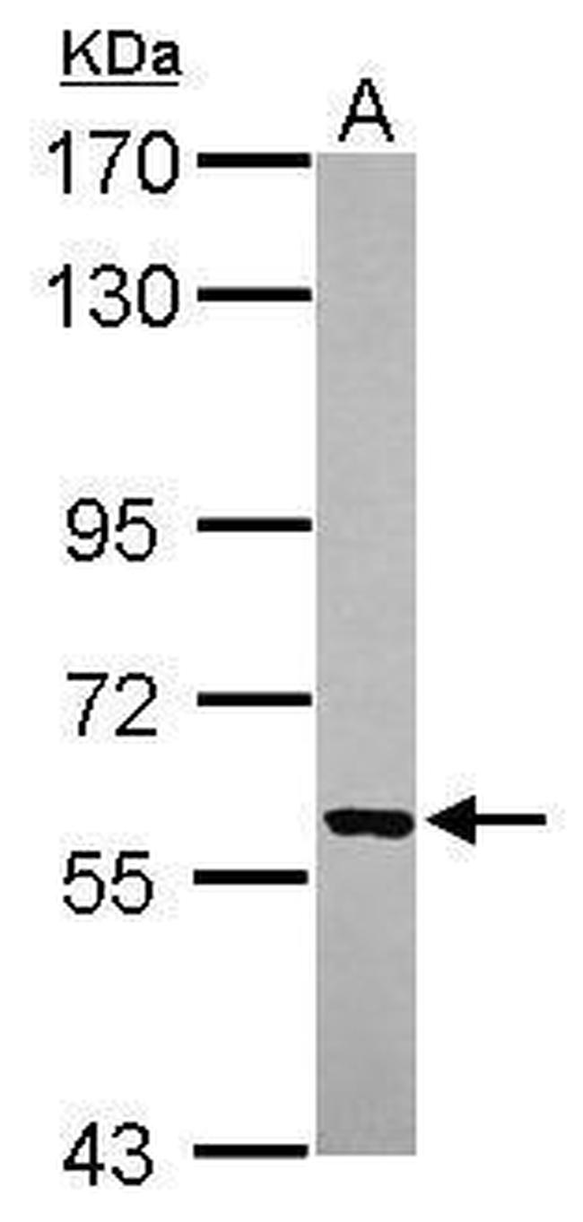 VLK Antibody in Western Blot (WB)