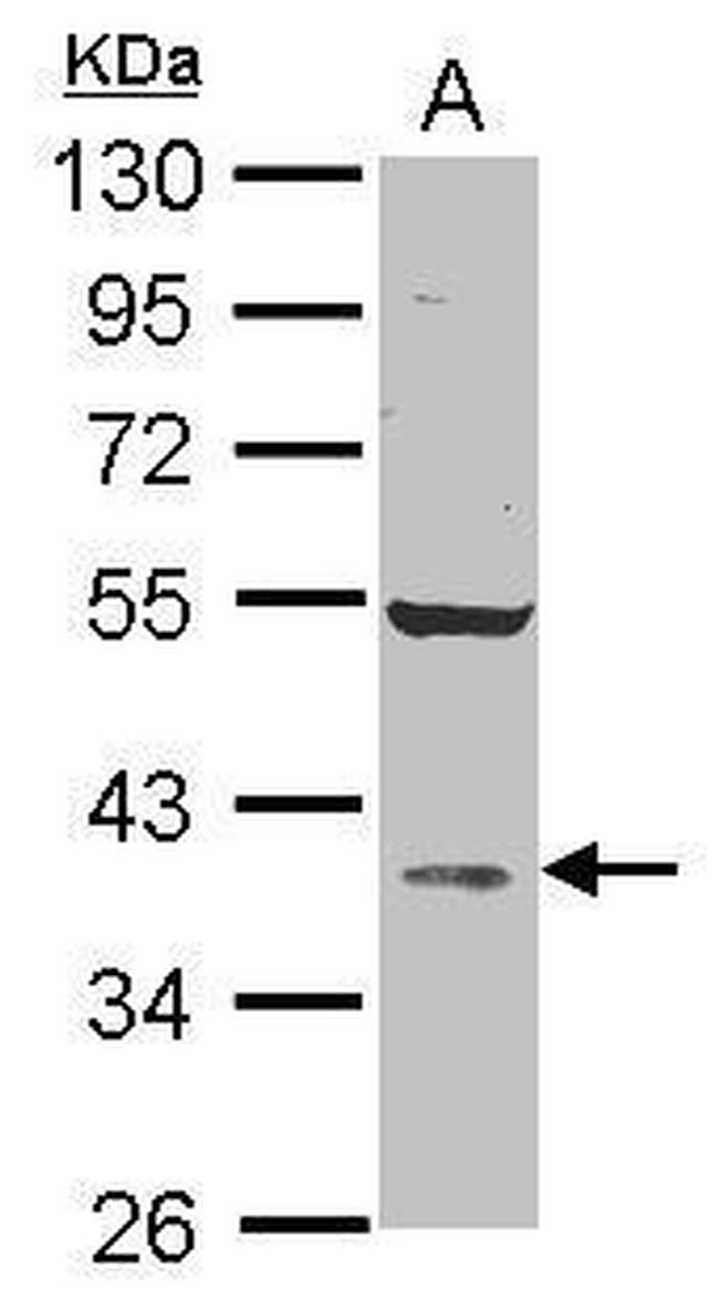AKR1D1 Antibody in Western Blot (WB)