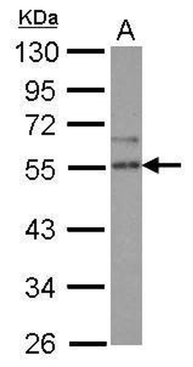SPRED2 Antibody in Western Blot (WB)