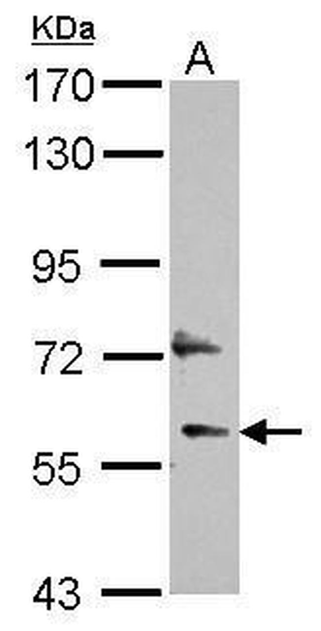 DEPDC7 Antibody in Western Blot (WB)