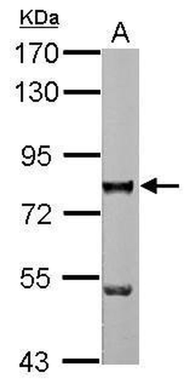 ZNF179 Antibody in Western Blot (WB)