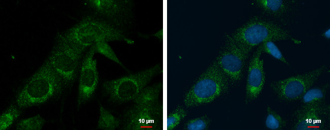 PRELID1 Antibody in Immunocytochemistry (ICC/IF)