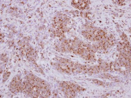 PRELID1 Antibody in Immunohistochemistry (Paraffin) (IHC (P))