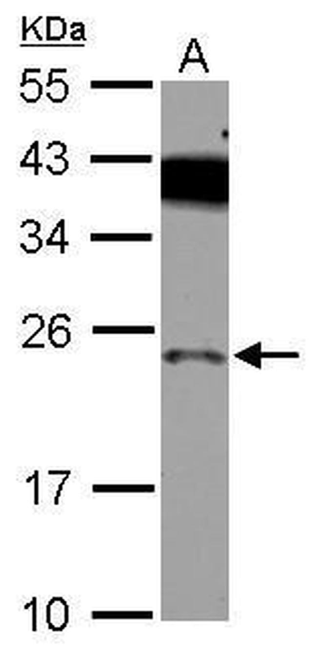 PRELID1 Antibody in Western Blot (WB)