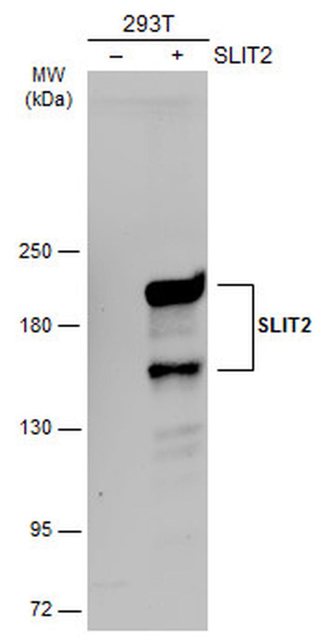 SLIT2 Antibody in Western Blot (WB)