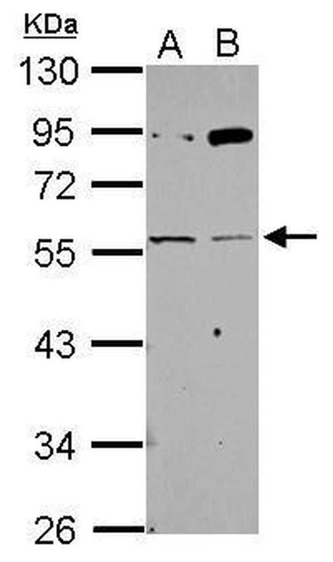 CHRNG Antibody in Western Blot (WB)