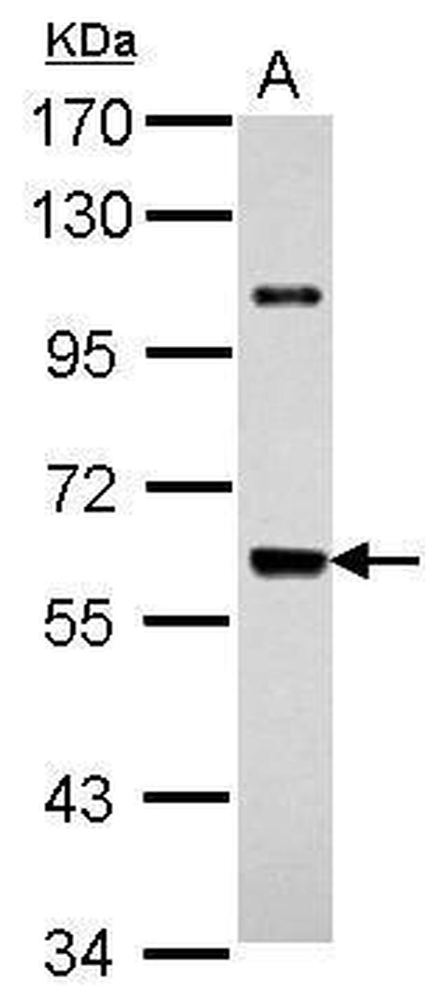 UAP1 Antibody in Western Blot (WB)