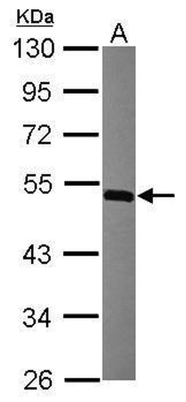 MINA53 Antibody in Western Blot (WB)