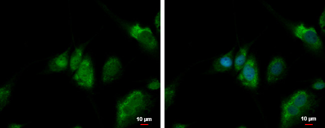 QTRT1 Antibody in Immunocytochemistry (ICC/IF)