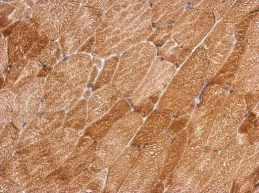 QTRT1 Antibody in Immunohistochemistry (Paraffin) (IHC (P))