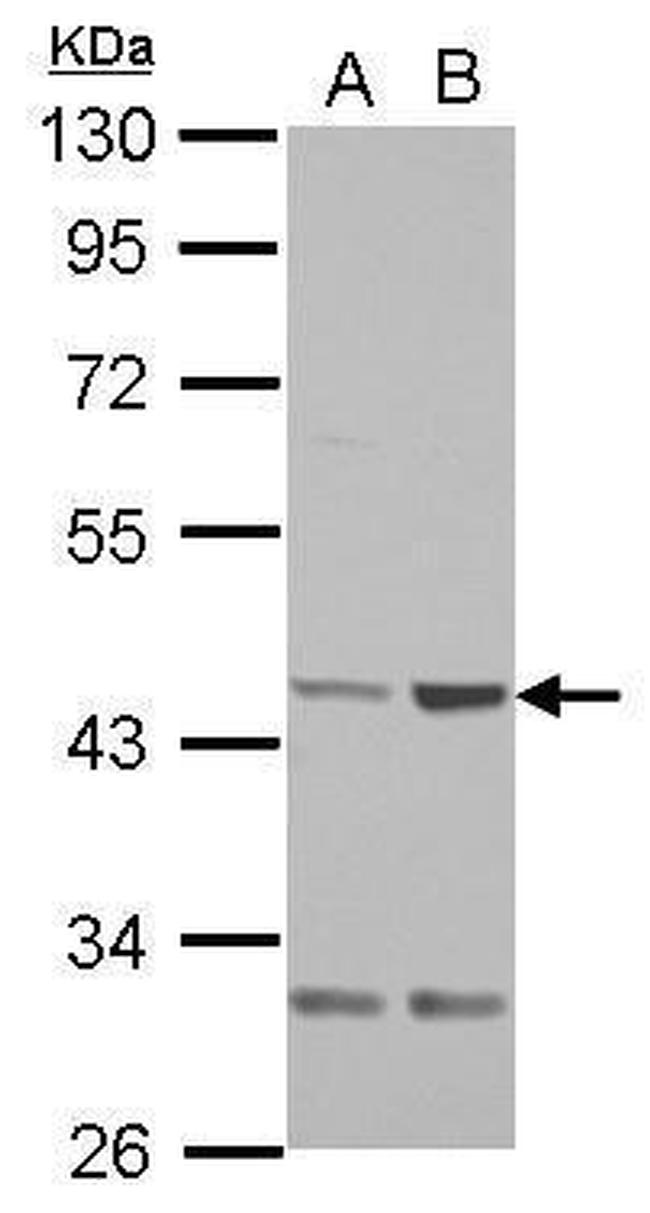 QTRT1 Antibody in Western Blot (WB)