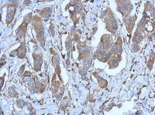 P2X2 Antibody in Immunohistochemistry (Paraffin) (IHC (P))