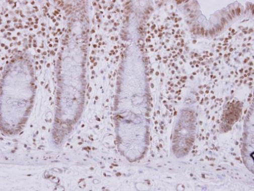 ASB7 Antibody in Immunohistochemistry (Paraffin) (IHC (P))