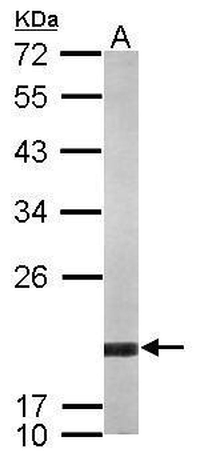 ARF5 Antibody in Western Blot (WB)