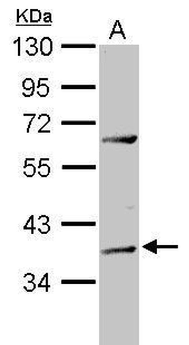 ADAT1 Antibody in Western Blot (WB)