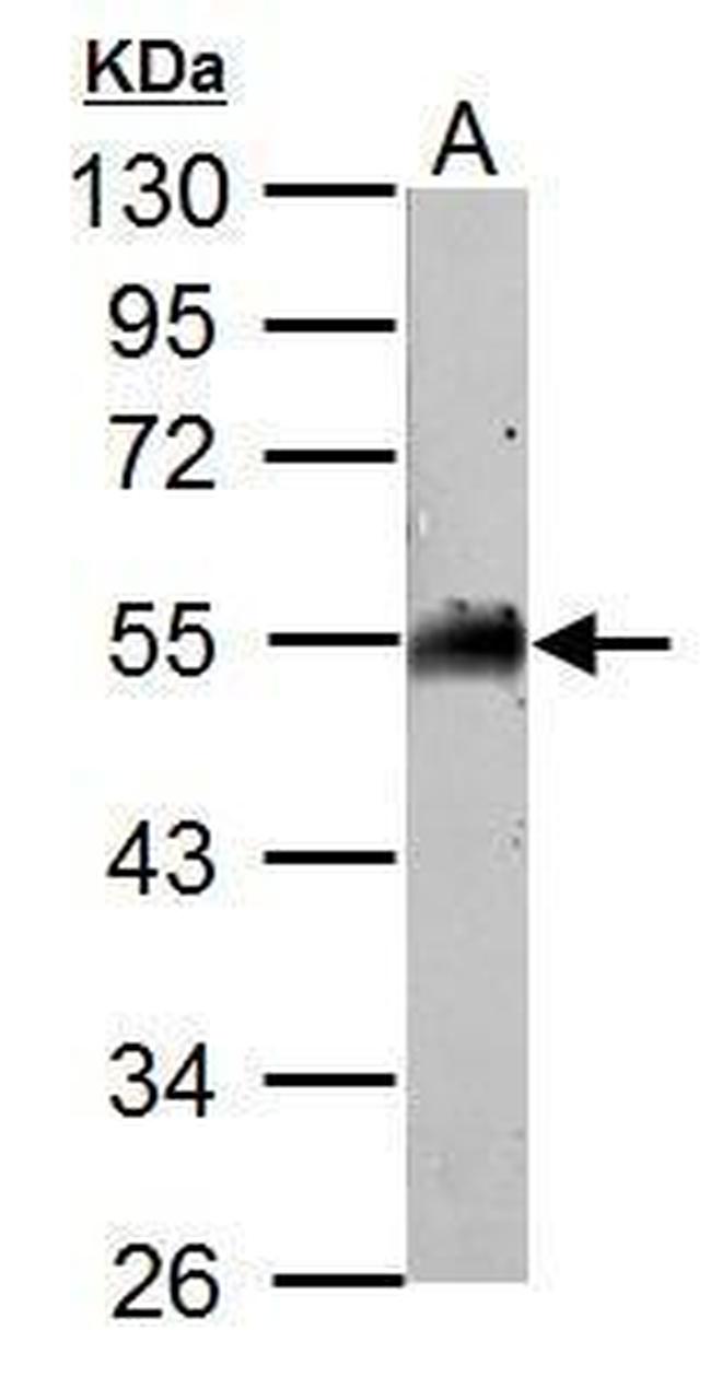 AAMP Antibody in Western Blot (WB)