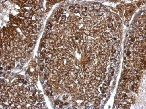 PDHB Antibody in Immunohistochemistry (Paraffin) (IHC (P))