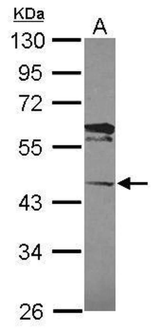 LACC1 Antibody in Western Blot (WB)