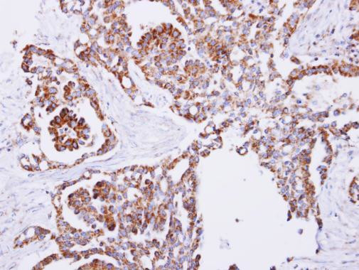 PITRM1 Antibody in Immunohistochemistry (Paraffin) (IHC (P))