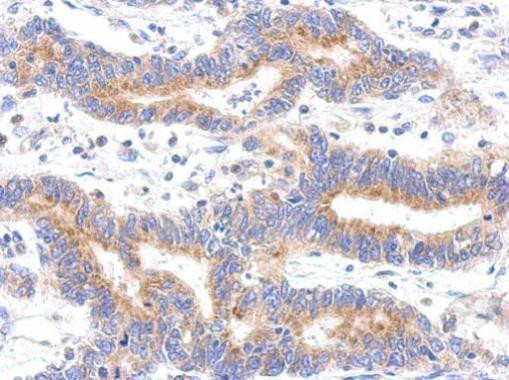 HDHD3 Antibody in Immunohistochemistry (Paraffin) (IHC (P))