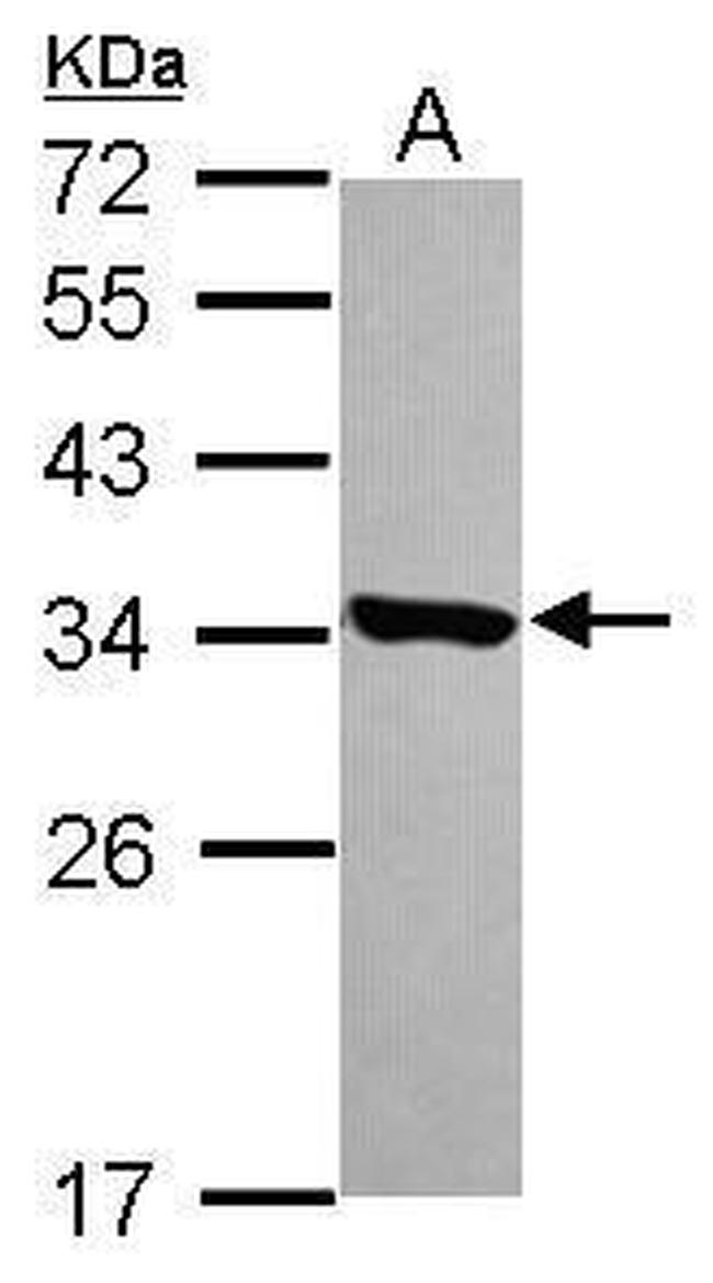 HDHD3 Antibody in Western Blot (WB)