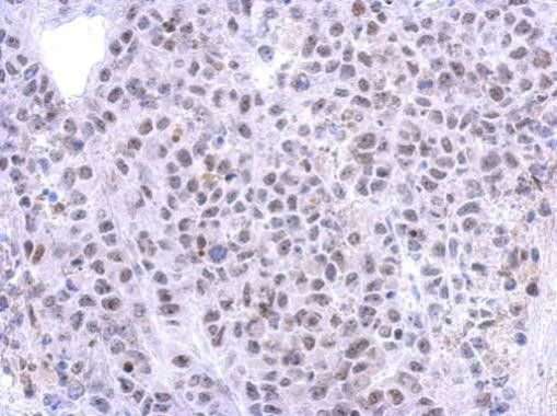 RRP12 Antibody in Immunohistochemistry (Paraffin) (IHC (P))