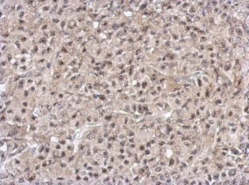 PELO Antibody in Immunohistochemistry (Paraffin) (IHC (P))