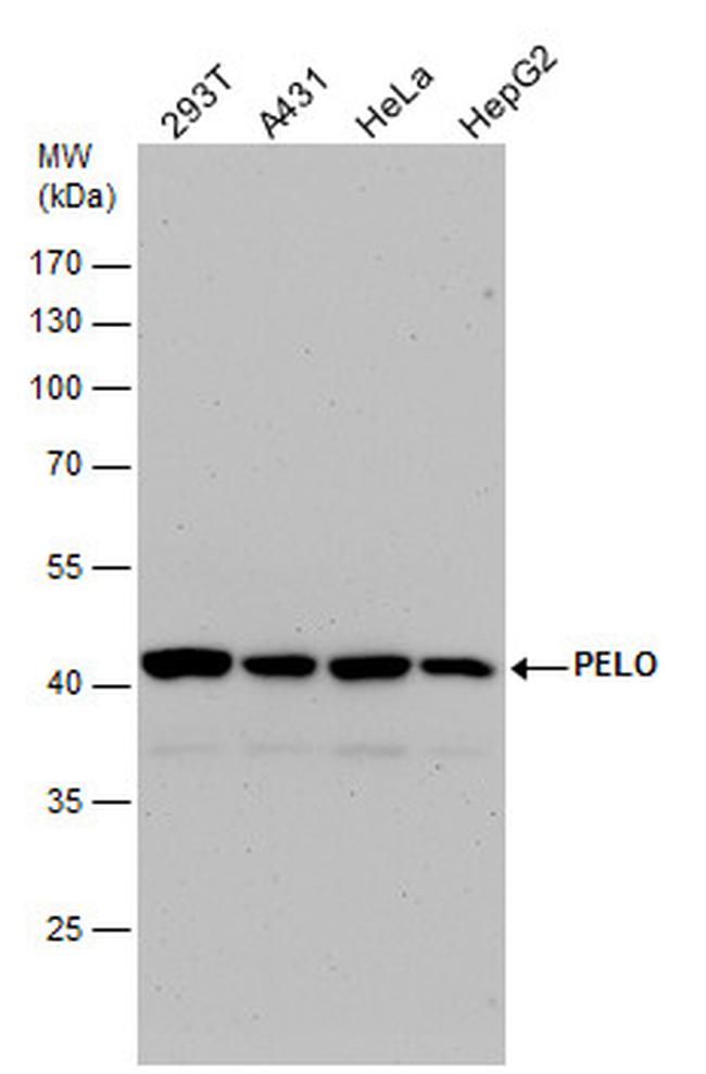 PELO Antibody in Western Blot (WB)