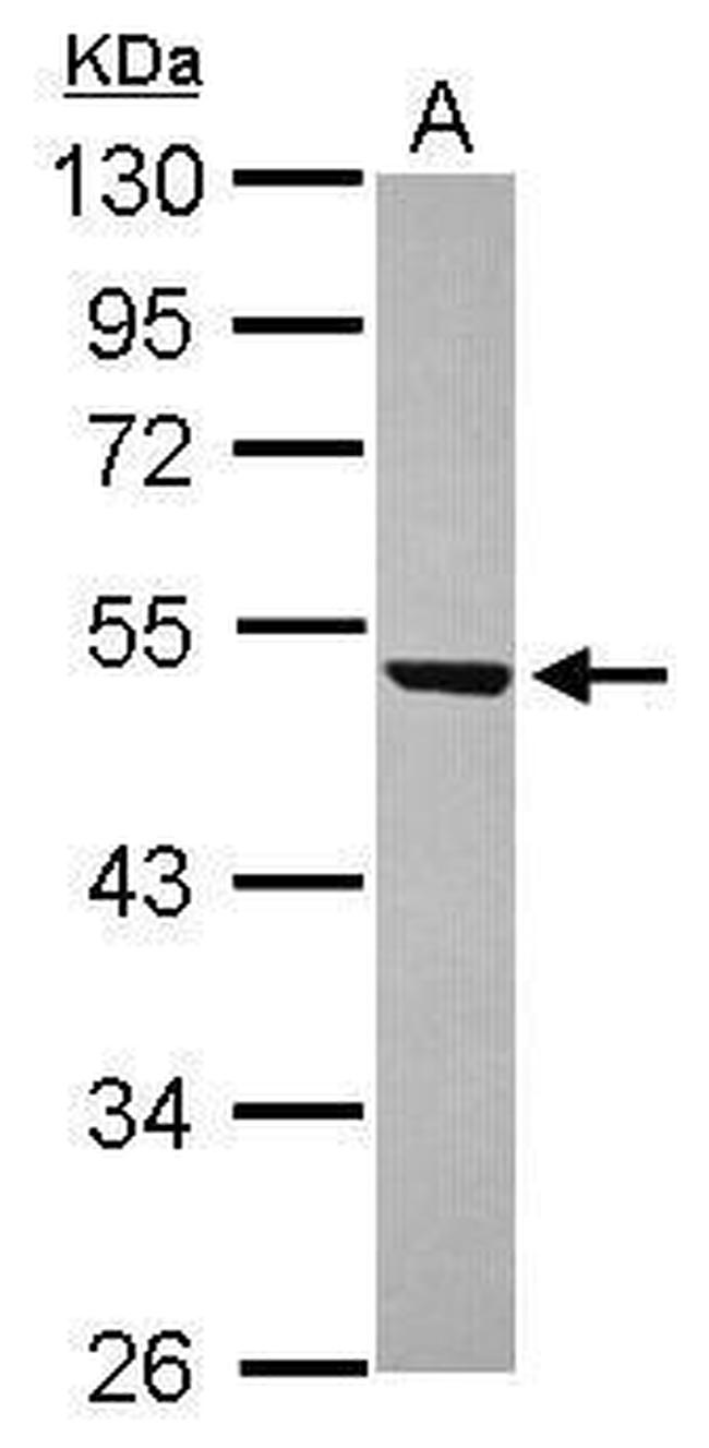 WDR12 Antibody in Western Blot (WB)