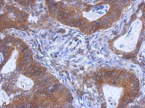 WDR85 Antibody in Immunohistochemistry (Paraffin) (IHC (P))