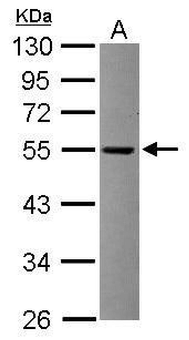 TRIT1 Antibody in Western Blot (WB)