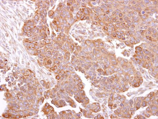 METTL13 Antibody in Immunohistochemistry (Paraffin) (IHC (P))