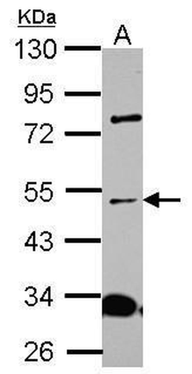 ICA1L Antibody in Western Blot (WB)