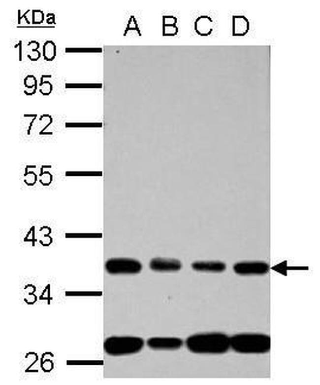 NUP35 Antibody in Western Blot (WB)