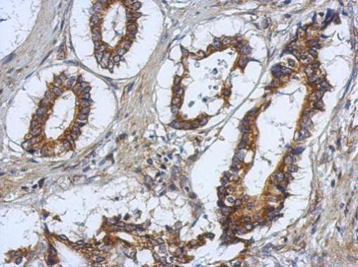 RASAL2 Antibody in Immunohistochemistry (Paraffin) (IHC (P))