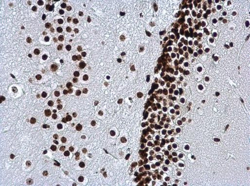 H3K27me3 Antibody in Immunohistochemistry (Paraffin) (IHC (P))