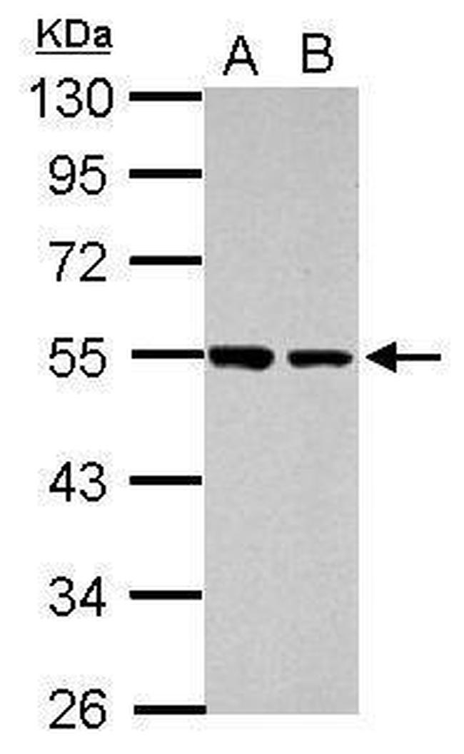 DUS2L Antibody in Western Blot (WB)