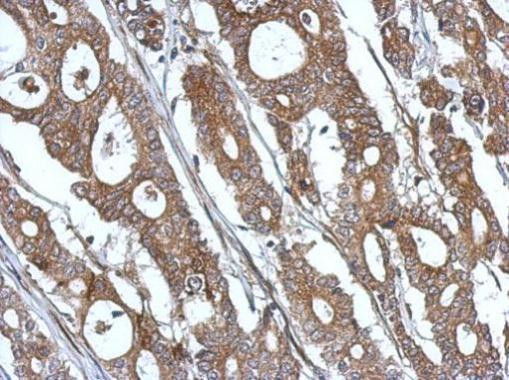 ISG15 Antibody in Immunohistochemistry (Paraffin) (IHC (P))