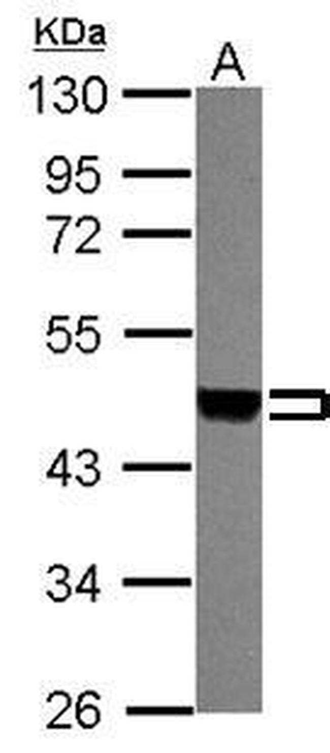 MEK1/MEK2 Antibody in Western Blot (WB)